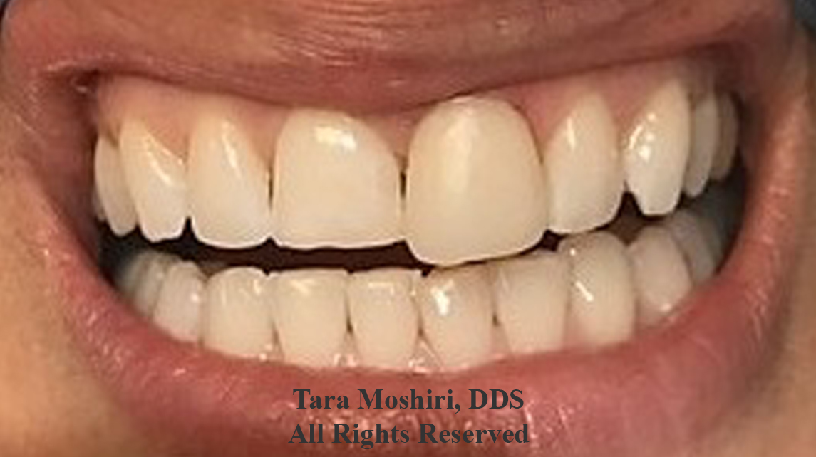 Artiste Dentistry LLC: Tara Moshiri, DDS