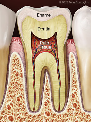 root canals in sterling, VA